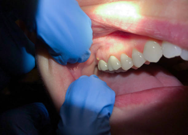 Best Pediatric Emergency Dentist in The Plains, OH