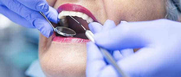 Best Urgent Care for Lost Fillings or Crowns in The Plains, OH